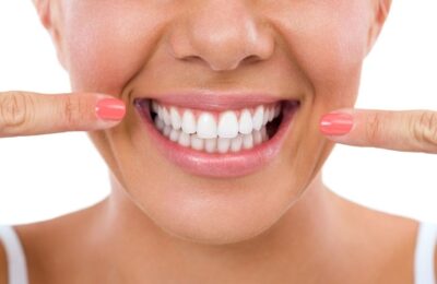 L'importanza dei denti bianchi: Perché è importante avere denti bianchi?